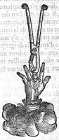 An illustration from La maniere de traicter les playes faictes tant par hacquebutes, que par fleches : et les accidentz d’icelles, comme fractures et caries des os, gangrene et mortification : avec les pourtraictz des instrumentz necessaires pour leur curation. Et la methode de curer les combustions principalement faictes par la pouldre à canon. Le tout composé par Ambroise Paré, maistre Barbier Chirurgien à Paris (1552)