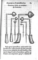 An illustration from La maniere de traicter les playes faictes tant par hacquebutes, que par fleches : et les accidentz d’icelles, comme fractures et caries des os, gangrene et mortification : avec les pourtraictz des instrumentz necessaires pour leur curation. Et la methode de curer les combustions principalement faictes par la pouldre à canon. Le tout composé par Ambroise Paré, maistre Barbier Chirurgien à Paris (1552)
