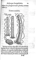 An illustration from La maniere de traicter les playes faictes tant par hacquebutes, que par fleches : et les accidentz d’icelles, comme fractures et caries des os, gangrene et mortification : avec les pourtraictz des instrumentz necessaires pour leur curation. Et la methode de curer les combustions principalement faictes par la pouldre à canon. Le tout composé par Ambroise Paré, maistre Barbier Chirurgien à Paris (1552)