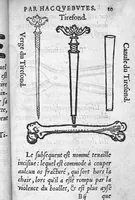 An illustration from La Méthode de traicter les playes faictes par hacquebutes et aultres bastons à feu et de celles qui sont faictes par flèches, dardz et semblables, aussy des combustions spécialement faictes par la pouldre à canon, composée par Ambroyse Paré,... (1545)