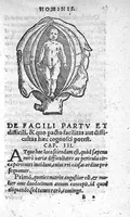 An illustration from De partu hominis (1556)