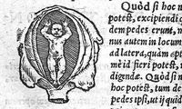 An illustration from De partu hominis (1556)