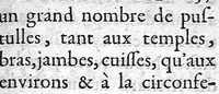 An illustration from La doctrine des raports de chirurgie fondée sur les maximes d'usage et sur la disposition des nouvelles ordonnances (1684)