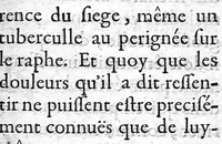 An illustration from La doctrine des raports de chirurgie fondée sur les maximes d'usage et sur la disposition des nouvelles ordonnances (1684)