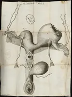 An illustration from Histoire anatomique d'une matrice extraordinaire (1683)
