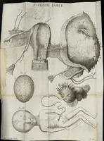 Picture 4 of 4 from Histoire anatomique d'une matrice extraordinaire (1683), leaf 43