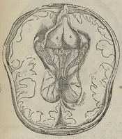 Picture 4 of 18 from L'Oeconomie chirurgicale, pour le restablissement des parties molles du corps humain. Contenant les principes de chirurgie, & un Traitté methodique de la garison de la peste, & de tous ses accidents, par le moyen d'un remede experimenté. Et nouvellement mis en lumiere... (1671), leaf 285