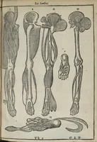 Picture 6 of 18 from L'Oeconomie chirurgicale, pour le restablissement des parties molles du corps humain. Contenant les principes de chirurgie, & un Traitté methodique de la garison de la peste, & de tous ses accidents, par le moyen d'un remede experimenté. Et nouvellement mis en lumiere... (1671), leaf 354