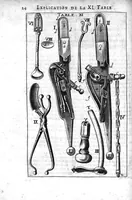 An illustration from L'arcenal de chirurgie (1675)