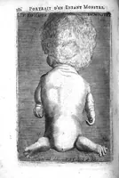 Picture 16 of 17 from L'arcenal de chirurgie (1675), leaf 397