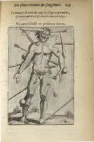 An illustration from Les Institutions chirurgiques (1629)