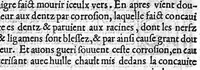 An illustration from De Vigo en françoys. La practique et cirurgie de excellent docteur en medecine Maistre Jehan de Vigo nouvellement imprimee et recogneue diligentement sur le latin avec les aphorismes et canons de cirurgie, composez par maistre Nicolas Godin docteur en medecine lesquelz sont inserez en la fin de ce present livre apres la partie compendieuse. Division de ladicte practique. La premiere partie est nommee la copieuse contenant neuf livres particuliers. La seconde est dicte compendieuse qui contient cinq livres particuliers : lesquelz sont declarez en la page sequente (1542)