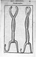 Picture 1 of 17 from Traité des Hernies contenant une ample declaration de toutes leurs especes, et autres excellentes parties de la Chirurgie,assavoir de la pierre, des cataractes des yeux, et autres maladies, desquelles comme la cure est perilleuse, aussi est elle de peu d’hommes bien exercée : Avec leurs causes, signes, accidens, anatomie des parties affectées, et leur entiere guarison : Par Pierre Franco de Turriers en Provence, demeurant à present à Orange (1561), leaf 168