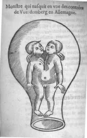 Picture 12 of 13 from Des divers travaulx et enfantemens des femmes. Et par quel moyen lon doibt survenir aux accidens qui peuvent eschoir devant et apres iceux travaulx, devisé en deux petiz livres. Premierement composez en Latin, par maistre Euchaire Rodion, Docteur en Medecine, et depuis tournez en nostre langue Françoyse, et augmentez de Annotations, par M. Paul Bienassis de Poictiers, à l’utilité de plusieurs personnes. Avec Indice des choses memorables contenues en ce present livre, mises par chapitres en la fin d’icelluy (1563), leaf 287