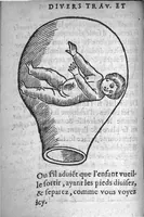 An illustration from Des divers travaulx et enfantemens des femmes. Et par quel moyen lon doibt survenir aux accidens qui peuvent eschoir devant et apres iceux travaulx, devisé en deux petiz livres. Premierement composez en Latin, par maistre Euchaire Rodion, Docteur en Medecine, et depuis tournez en nostre langue Françoyse, et augmentez de Annotations, par M. Paul Bienassis de Poictiers, à l’utilité de plusieurs personnes. Avec Indice des choses memorables contenues en ce present livre, mises par chapitres en la fin d’icelluy (1563)