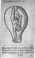 An illustration from Des divers travaulx et enfantemens des femmes. Et par quel moyen lon doibt survenir aux accidens qui peuvent eschoir devant et apres iceux travaulx, devisé en deux petiz livres. Premierement composez en Latin, par maistre Euchaire Rodion, Docteur en Medecine, et depuis tournez en nostre langue Françoyse, et augmentez de Annotations, par M. Paul Bienassis de Poictiers, à l’utilité de plusieurs personnes. Avec Indice des choses memorables contenues en ce present livre, mises par chapitres en la fin d’icelluy (1563)