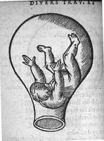 An illustration from Des divers travaulx et enfantemens des femmes. Et par quel moyen lon doibt survenir aux accidens qui peuvent eschoir devant et apres iceux travaulx, devisé en deux petiz livres. Premierement composez en Latin, par maistre Euchaire Rodion, Docteur en Medecine, et depuis tournez en nostre langue Françoyse, et augmentez de Annotations, par M. Paul Bienassis de Poictiers, à l’utilité de plusieurs personnes. Avec Indice des choses memorables contenues en ce present livre, mises par chapitres en la fin d’icelluy (1563)