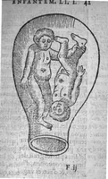 An illustration from Des divers travaulx et enfantemens des femmes. Et par quel moyen lon doibt survenir aux accidens qui peuvent eschoir devant et apres iceux travaulx, devisé en deux petiz livres. Premierement composez en Latin, par maistre Euchaire Rodion, Docteur en Medecine, et depuis tournez en nostre langue Françoyse, et augmentez de Annotations, par M. Paul Bienassis de Poictiers, à l’utilité de plusieurs personnes. Avec Indice des choses memorables contenues en ce present livre, mises par chapitres en la fin d’icelluy (1563)