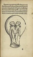 An illustration from De partu hominis, et quae circa ipsum accidunt. Libellus D. Eucharii Rhodionis (1532)