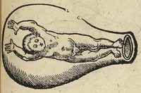 Picture 4 of 14 from De partu hominis, et quae circa ipsum accidunt. Libellus D. Eucharii Rhodionis (1532), leaf 54