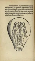 An illustration from De partu hominis, et quae circa ipsum accidunt. Libellus D. Eucharii Rhodionis (1532)