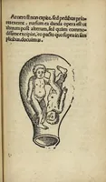 Picture 13 of 14 from De partu hominis, et quae circa ipsum accidunt. Libellus D. Eucharii Rhodionis (1532), leaf 66