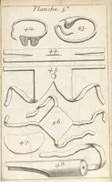 An illustration from Traité complet des operations de chirurgie : contenant leurs definitions, leurs causes expliquées sur la structure de la partie, les signes des maladies qui nous obligent de faire l'operation... (1698)