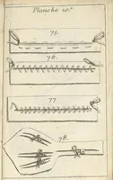 Picture 12 of 14 from Traité complet des operations de chirurgie : contenant leurs definitions, leurs causes expliquées sur la structure de la partie, les signes des maladies qui nous obligent de faire l'operation... (1698), leaf 900
