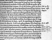 An illustration from La grande chirurgie de M. Gui de Chauliac, Medecin tres-fameux de l’Université de Monpelier, composee l’an de grace M.CCC.LXIII. Restituee nouvellement a sa dignité, par M. Laurens Joubert, Medecin ordinaire du Roy, et du Roy de Navarre, premier Docteur regent stipendié, Chancelier et Juge de ladicte Université. Voyez au prochain feuillet, ce que M. Joubert ha faict (outre sa nouvelle traduction) et fourny du sien, en recognoissant cest’ œuvre, (1579)