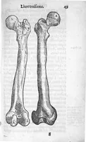 An illustration from Dix livres de la chirurgie avec le Magasin des Instrumens necessaires à icelle. Par Ambroise Paré, premier Chirurgien du Roy et juré à Paris (1564)