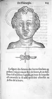 Picture 16 of 22 from Dix livres de la chirurgie avec le Magasin des Instrumens necessaires à icelle. Par Ambroise Paré, premier Chirurgien du Roy et juré à Paris (1564), leaf 479