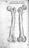 Picture 2 of 16 from Cinq livres de chirurgie. I. Des bandages 2. Des fractures. 3. Des luxations, avec une Apologie touchant les harquebousades. 4. Des morsures et piqueures venimeuses. 5. Des gouttes. Par Ambroise Paré, premier Chirurgien du Roy et juré à Paris, (1572), leaf 109