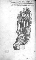 An illustration from Cinq livres de chirurgie. I. Des bandages 2. Des fractures. 3. Des luxations, avec une Apologie touchant les harquebousades. 4. Des morsures et piqueures venimeuses. 5. Des gouttes. Par Ambroise Paré, premier Chirurgien du Roy et juré à Paris, (1572)