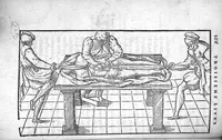 Picture 4 of 16 from Cinq livres de chirurgie. I. Des bandages 2. Des fractures. 3. Des luxations, avec une Apologie touchant les harquebousades. 4. Des morsures et piqueures venimeuses. 5. Des gouttes. Par Ambroise Paré, premier Chirurgien du Roy et juré à Paris, (1572), leaf 189
