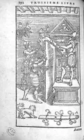 Picture 7 of 16 from Cinq livres de chirurgie. I. Des bandages 2. Des fractures. 3. Des luxations, avec une Apologie touchant les harquebousades. 4. Des morsures et piqueures venimeuses. 5. Des gouttes. Par Ambroise Paré, premier Chirurgien du Roy et juré à Paris, (1572), leaf 215