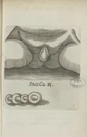 Picture 22 of 25 from Le chemin frayé et infaillible aux accouchemens, qui servira de flambeau aux sages-femmes, pour les éclairer en leurs operations, cachées dans les plus obscures cavernes de la matrice. Le tout enrichi de diverses figures... (1689), leaf 104