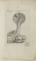Picture 12 of 25 from Le chemin frayé et infaillible aux accouchemens, qui servira de flambeau aux sages-femmes, pour les éclairer en leurs operations, cachées dans les plus obscures cavernes de la matrice. Le tout enrichi de diverses figures... (1689), leaf 68