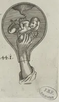 An illustration from Le chemin frayé et infaillible aux accouchemens, qui servira de flambeau aux sages-femmes, pour les éclairer en leurs operations, cachées dans les plus obscures cavernes de la matrice. Le tout enrichi de diverses figures... (1689)