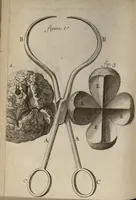 An illustration from Lettre de Monsieur Helvetius...sur la nature et la guerison du cancer (1691)