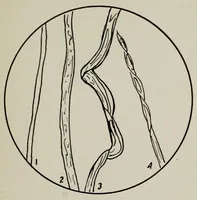An illustration from Sewing and textiles; a textbook for grades and rural schools, prepared in the Extension division of the University of Wisconsin (1918)