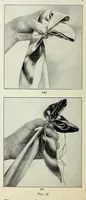 An illustration from Ribbon and fabric trimmings : a variety of appropriate dress trimmings that can be made from ribbon and fabric, with directions for their making (1925)
