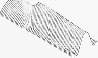 An illustration from An Application of Computer Graphics: Two Concurrent Investigations Within the Medical Field, (1971)