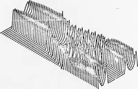 An illustration from An Application of Computer Graphics: Two Concurrent Investigations Within the Medical Field, (1971)