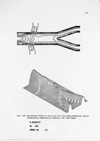 Picture 47 of 63 from An Application of Computer Graphics: Two Concurrent Investigations Within the Medical Field, (1971), leaf 202