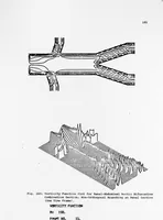 Picture 50 of 63 from An Application of Computer Graphics: Two Concurrent Investigations Within the Medical Field, (1971), leaf 206