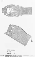 Picture 57 of 63 from An Application of Computer Graphics: Two Concurrent Investigations Within the Medical Field, (1971), leaf 217