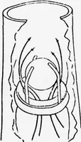 Picture 4 of 63 from An Application of Computer Graphics: Two Concurrent Investigations Within the Medical Field, (1971), leaf 36