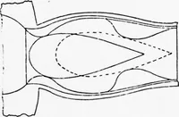 An illustration from An Application of Computer Graphics: Two Concurrent Investigations Within the Medical Field, (1971)