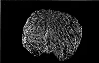 An illustration from Three-Dimensional Computer Graphics Brain-Mapping Project (1988)
