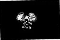 An illustration from Three-Dimensional Computer Graphics Brain-Mapping Project (1988)